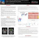 Changes in Sleep Apnea-Related Structures Following Radiation Therapy in Oropharyngeal Cancer Patients