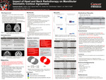 Impact of Head and Neck Radiotherapy on Mandibular Geometric Contour Agreement
