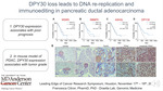 DPY30 loss leads to DNA re-replication and immunoediting in pancreatic ductal adenocarcinoma