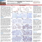 SPOP Mutations Promote Prostate Cancer Progression and Metastasis