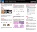 Creation and characterization of patient derived xenograft animal model of hereditary leiomyomatosis associated renal cell carcinoma