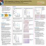 CCR4 Antagonists in Cutaneous T-Cell Lymphoma (CTCL)