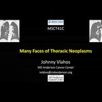 Many Faces of Thoracic Neoplasms by Ioannis "Johnny" Vlahos PhD